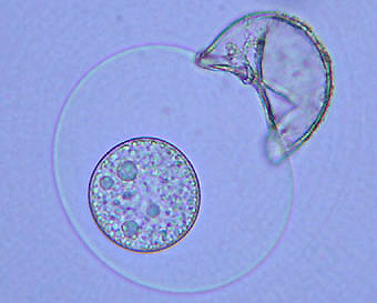 嫌な時期ですねぇ･･･。